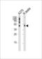 Adaptor Related Protein Complex 1 Subunit Mu 1 antibody, LS-C156382, Lifespan Biosciences, Western Blot image 