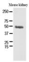 Proteasome 26S Subunit, Non-ATPase 11 antibody, GTX50018, GeneTex, Western Blot image 