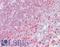 Tumor protein D52 antibody, LS-B9195, Lifespan Biosciences, Immunohistochemistry paraffin image 