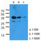 Kallikrein Related Peptidase 3 antibody, AM50013PU-S, Origene, Western Blot image 