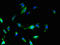 Solute Carrier Family 25 Member 18 antibody, LS-C397440, Lifespan Biosciences, Immunofluorescence image 