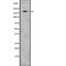 Transient Receptor Potential Cation Channel Subfamily M Member 2 antibody, abx219143, Abbexa, Western Blot image 