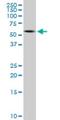 Peripherin antibody, H00005630-M02, Novus Biologicals, Western Blot image 