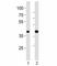 Pancreatic And Duodenal Homeobox 1 antibody, F52924-0.4ML, NSJ Bioreagents, Western Blot image 