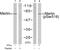 Neurofibromin 2 antibody, GTX79013, GeneTex, Western Blot image 