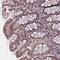 Zinc Finger CCCH-Type Containing 4 antibody, NBP1-88474, Novus Biologicals, Immunohistochemistry frozen image 