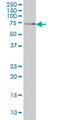 SH3 Domain Binding Protein 2 antibody, LS-C198186, Lifespan Biosciences, Western Blot image 