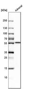 Cytochrome P450 Family 21 Subfamily A Member 2 antibody, HPA048979, Atlas Antibodies, Western Blot image 