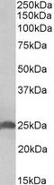 Apolipoprotein D antibody, LS-B10587, Lifespan Biosciences, Western Blot image 