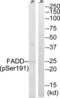 Fas Associated Via Death Domain antibody, LS-C198945, Lifespan Biosciences, Western Blot image 