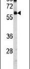 Ubiquitin Specific Peptidase 14 antibody, PA5-12015, Invitrogen Antibodies, Western Blot image 