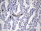 Cadherin 4 antibody, LS-C339294, Lifespan Biosciences, Immunohistochemistry paraffin image 