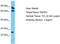 VPS26 Endosomal Protein Sorting Factor C antibody, TA330298, Origene, Western Blot image 