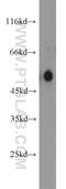 Carboxypeptidase M antibody, 16440-1-AP, Proteintech Group, Western Blot image 