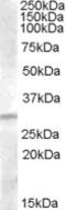 Tumor Suppressor Candidate 3 antibody, 46-721, ProSci, Western Blot image 