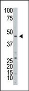 ADP-Ribosyltransferase 3 antibody, PA5-12123, Invitrogen Antibodies, Western Blot image 