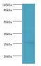 Homeobox A6 antibody, LS-C369795, Lifespan Biosciences, Western Blot image 