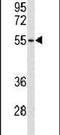 Acid Sensing Ion Channel Subunit 2 antibody, PA5-26222, Invitrogen Antibodies, Western Blot image 