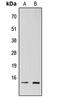 TATA-Box Binding Protein Associated Factor 13 antibody, LS-C358349, Lifespan Biosciences, Western Blot image 