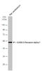 Gamma-Aminobutyric Acid Type A Receptor Alpha1 Subunit antibody, GTX133261, GeneTex, Western Blot image 