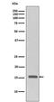 H3 Histone Family Member 3B antibody, P06819, Boster Biological Technology, Western Blot image 