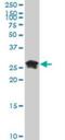 High Mobility Group Box 2 antibody, NBP1-69801, Novus Biologicals, Western Blot image 