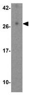 Epstein-Barr Virus Induced 3 antibody, GTX17030, GeneTex, Western Blot image 