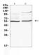ETS Proto-Oncogene 1, Transcription Factor antibody, A00931-2, Boster Biological Technology, Western Blot image 
