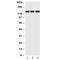Erb-B2 Receptor Tyrosine Kinase 4 antibody, R30981, NSJ Bioreagents, Western Blot image 