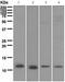 S100 Calcium Binding Protein A4 antibody, ab124805, Abcam, Western Blot image 