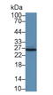 Interleukin 22 Receptor Subunit Alpha 2 antibody, LS-C695360, Lifespan Biosciences, Western Blot image 