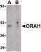 ORAI Calcium Release-Activated Calcium Modulator 1 antibody, PA5-20322, Invitrogen Antibodies, Western Blot image 