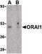 Calcium release-activated calcium channel protein 1 antibody, PA5-20322, Invitrogen Antibodies, Western Blot image 