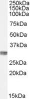 Chloride Intracellular Channel 4 antibody, NBP1-00172, Novus Biologicals, Western Blot image 