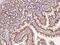 TOR Signaling Pathway Regulator antibody, 203316-T08, Sino Biological, Immunohistochemistry paraffin image 