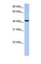 UDP-GlcNAc:BetaGal Beta-1,3-N-Acetylglucosaminyltransferase 7 antibody, NBP1-69637, Novus Biologicals, Western Blot image 