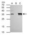 General Transcription Factor IIE Subunit 2 antibody, GTX105029, GeneTex, Immunoprecipitation image 