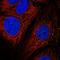 Adaptor Related Protein Complex 1 Subunit Mu 2 antibody, HPA054999, Atlas Antibodies, Immunofluorescence image 