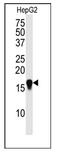 Small Ubiquitin Like Modifier 4 antibody, AP11269PU-N, Origene, Western Blot image 