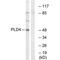 Phospholipase D Family Member 4 antibody, PA5-50089, Invitrogen Antibodies, Western Blot image 