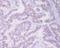 DNA Topoisomerase II Alpha antibody, M00953-1, Boster Biological Technology, Immunohistochemistry paraffin image 