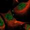 Interferon Regulatory Factor 4 antibody, NBP1-82813, Novus Biologicals, Immunocytochemistry image 