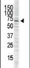 Calcium/Calmodulin Dependent Protein Kinase II Delta antibody, PA5-14036, Invitrogen Antibodies, Western Blot image 