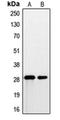 Prostate Stem Cell Antigen antibody, orb214768, Biorbyt, Western Blot image 