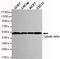 Tubulin antibody, STJ99132, St John