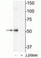 Histone Deacetylase 2 antibody, P00325, Boster Biological Technology, Western Blot image 