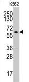 Cyclin A2 antibody, LS-C100873, Lifespan Biosciences, Western Blot image 