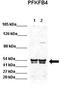 6-phosphofructo-2-kinase/fructose-2,6-biphosphatase 4 antibody, TA342218, Origene, Western Blot image 