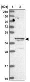 AlkB Homolog 1, Histone H2A Dioxygenase antibody, PA5-60609, Invitrogen Antibodies, Western Blot image 