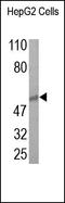 Transmembrane Phosphatase With Tensin Homology antibody, 251945, Abbiotec, Western Blot image 